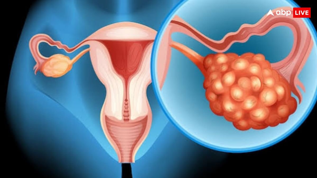 हर साल हजारों महिलाओं की जान ले लेता है ये कैंसर, नहीं पता चलते इसके लक्षण