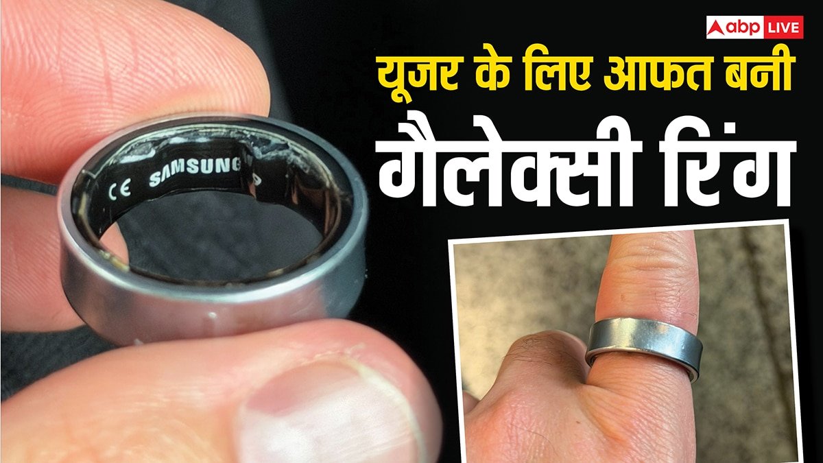 Samsung Galaxy Ring ने कर दिया कांड! हुआ कुछ ऐसा कि यूजर को ले जाना पड़ा अस्पताल, जानें मामला