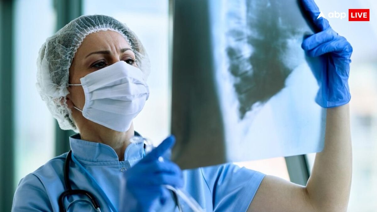 MDR-TB के इलाज के लिए अब नहीं करना होगा डेढ़ साल इंतजार, सिर्फ 6 महीने में ही पूरा हो जाएगा कोर्स