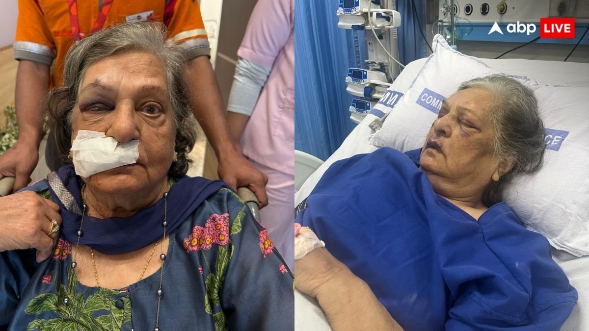 Air India ने बुजुर्ग महिला को नहीं दी व्हीलचेयर, गिरने से आई भयानक चोटें, बिना इलाज के चढ़ा दिया फ्लाइट में; ICU में भर्ती