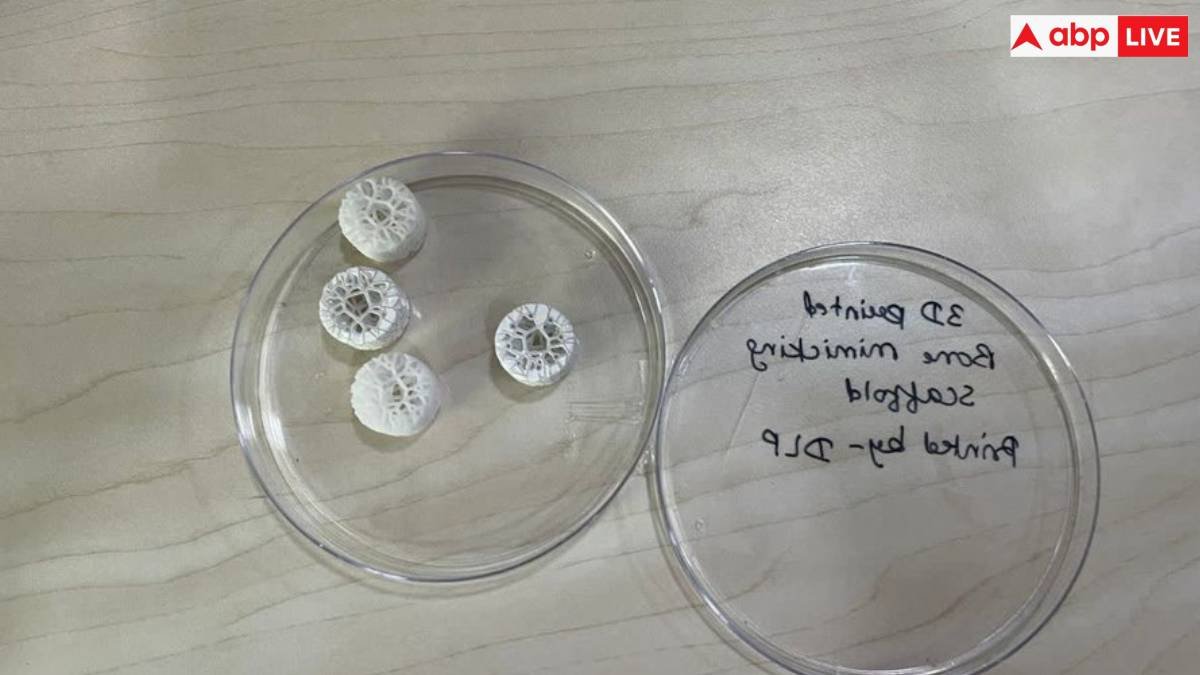 IIT कानुपर ने लैब में बनाया सिंथेटिक बोन, हड्डी के कैंसर और इंफेक्शन के इलाज में करेगा मदद