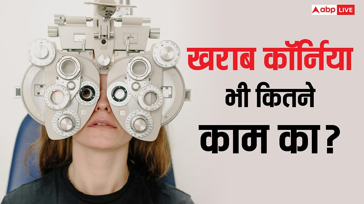 खराब कॉर्निया ट्रांसप्लांट कराकर भी देख सकेंगे नेत्रहीन, डॉक्टरों ने ढूंढ निकाला कमाल का फॉर्म्युला