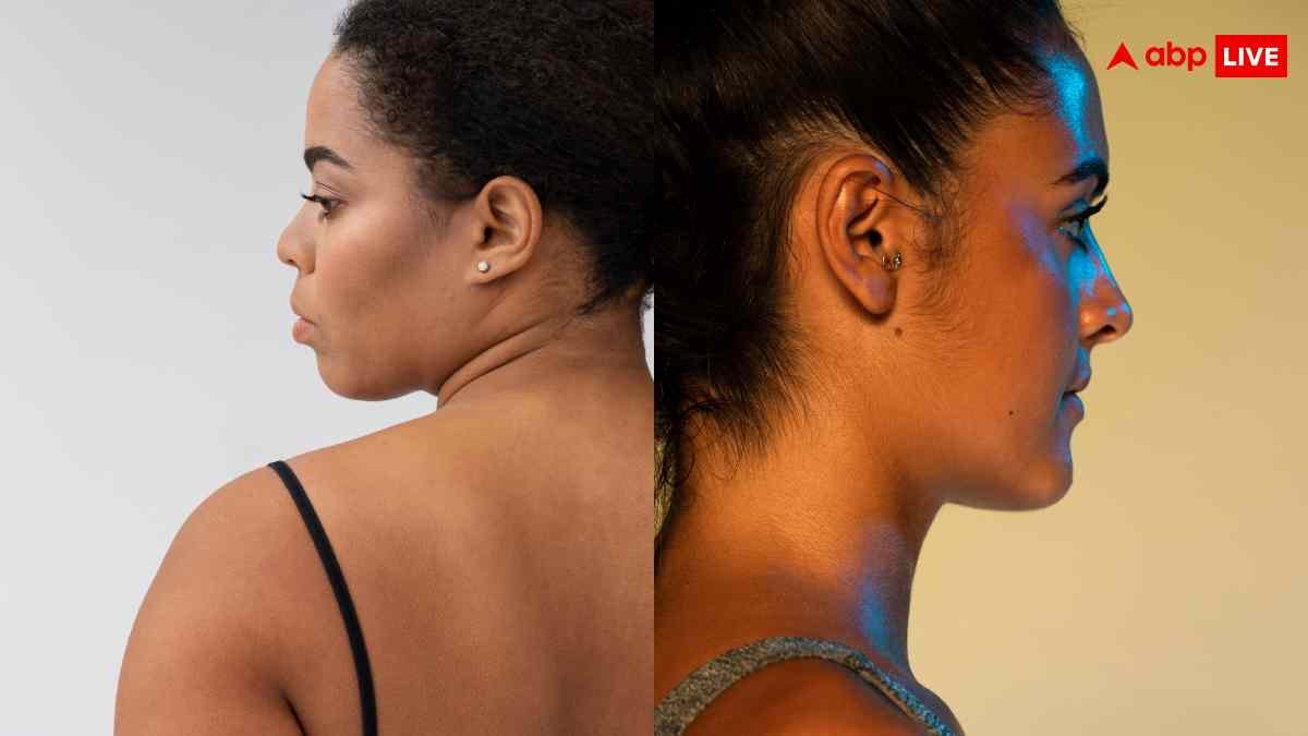 गर्दन के आसपास बनने लगा काले रंग का घेरा, इस बीमारी के शिकार तो नहीं हो रहे आप?