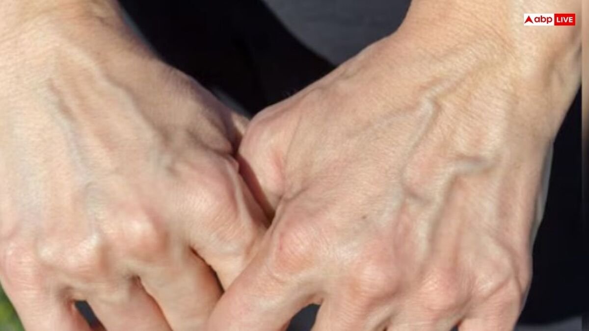 शरीर की नसें क्यों दिखती हैं नीली? जानिए इसके पीछे का दिलचस्प साइंस