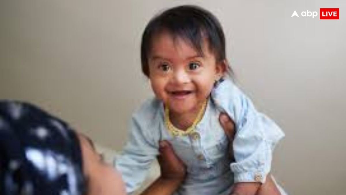 आपकी इन गलतियों की वजह से हो सकता है डाउन सिंड्रोम बेबी, हो जाएं सावधान