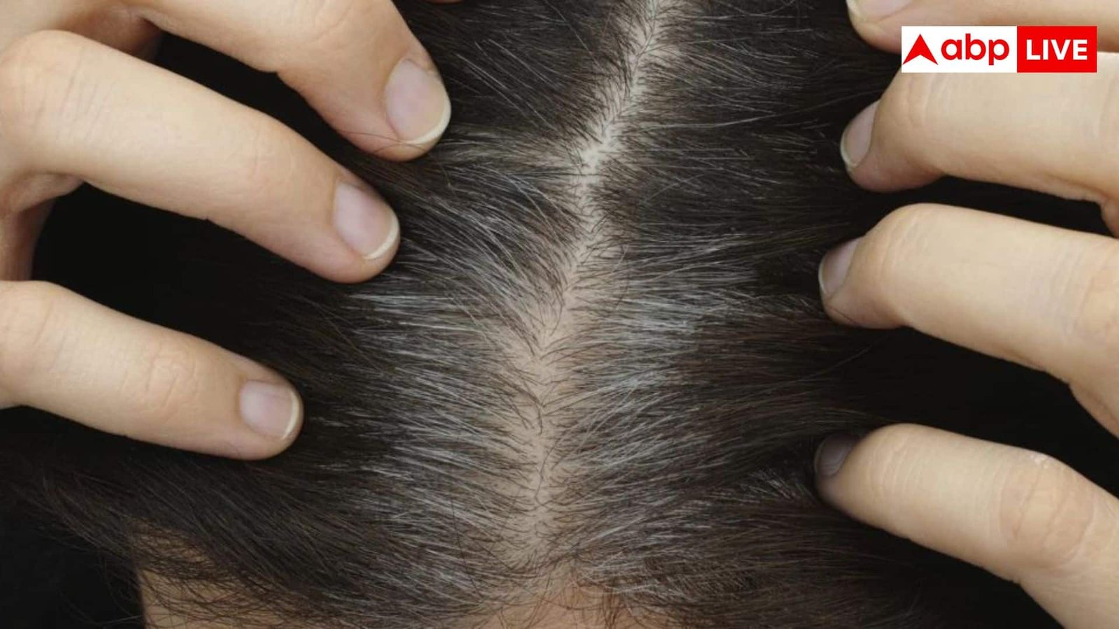 कुछ लोगों के बचपन से ही सफेद क्यों होने लगते हैं बाल, शरीर में इन विटामिन्स की हो सकती है कमी