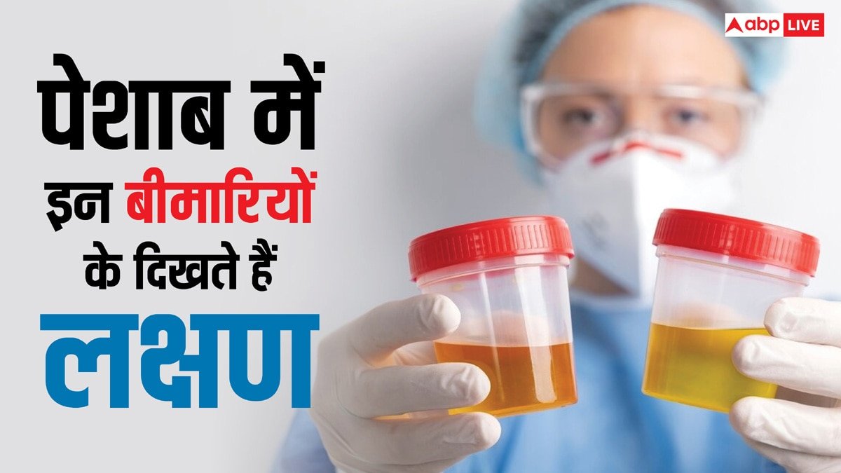 यूरिन में दिखने लगते हैं इस खतरनाक बीमारी के लक्षण, कहीं आप भी तो नहीं कर रहे इग्नोर?