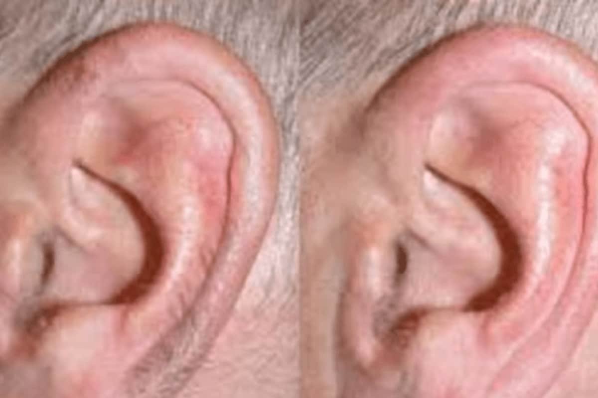 Samudrik Shastra Secrets: What Your Ear Hair Says About Your Luck, Health, And Mind