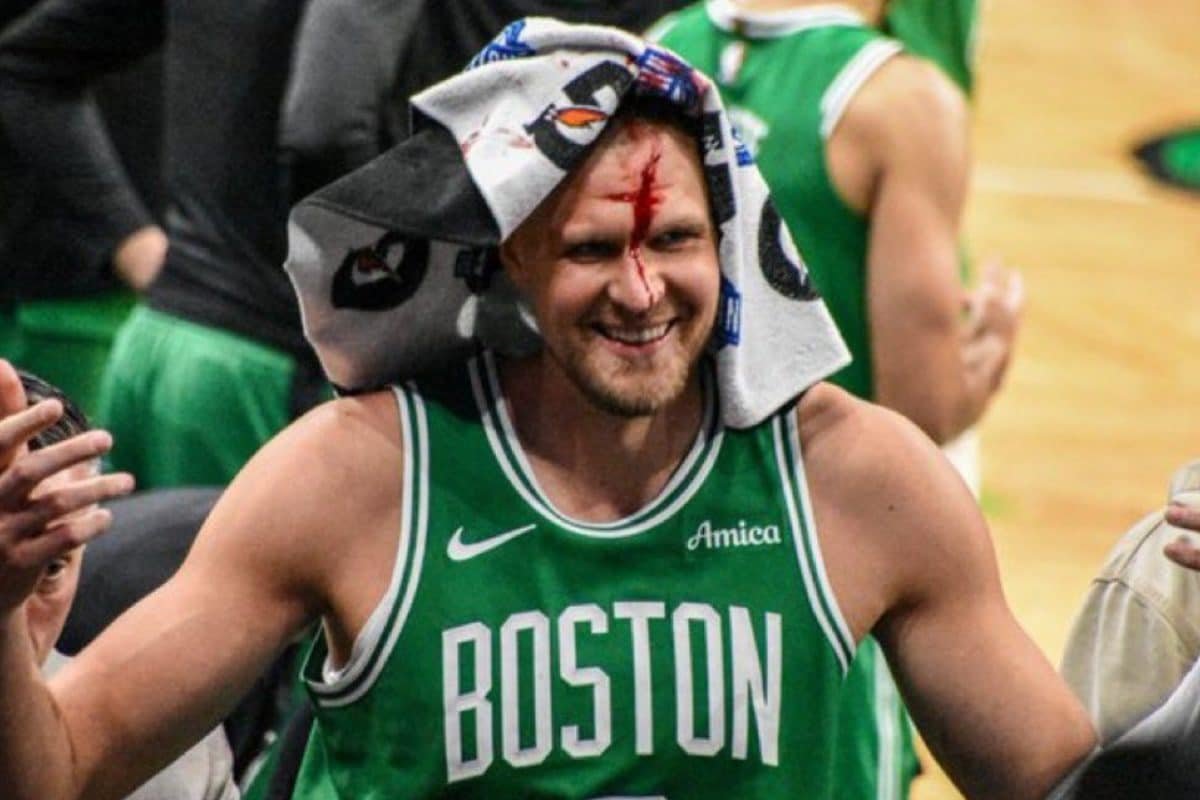WATCH: Celtics Kristaps Porzingis Takes Free Throws While Gushing Blood From Head After Flagrant Foul