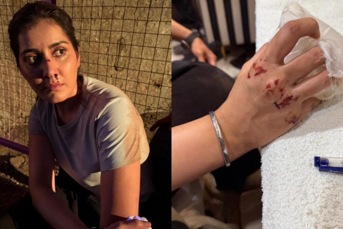 Raashii Khanna Bloodied, Bruised As Actress Shoots For Next Film | Photos Go Viral