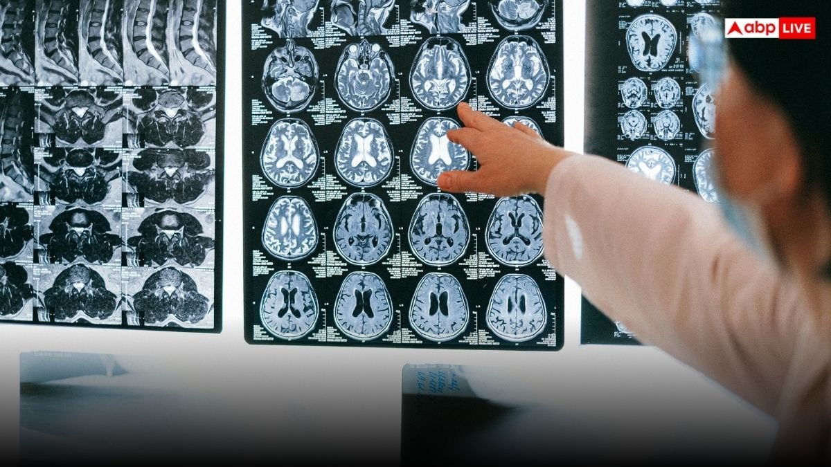 ये हैं दिमाग से जुड़ी पांच सबसे खतरनाक बीमारियां, ऐसे दिखते हैं लक्षण