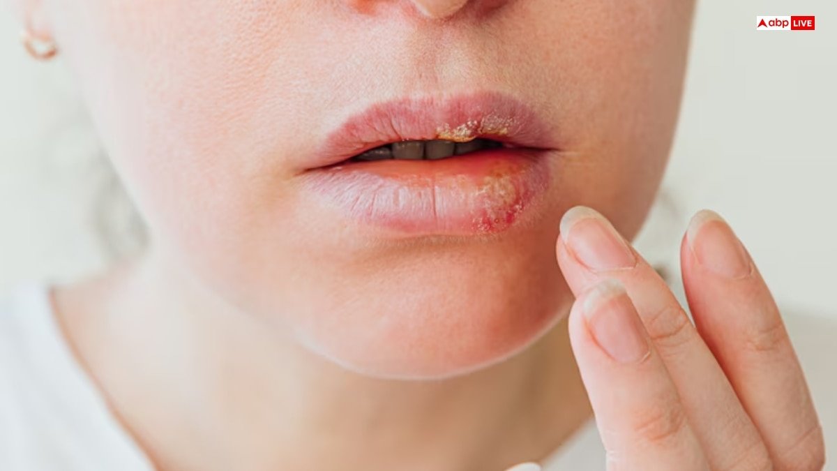 बार-बार सूख रहे हैं होंठ तो हो गई है इस चीज की कमी, सेहत के लिए हो सकता है खतरनाक