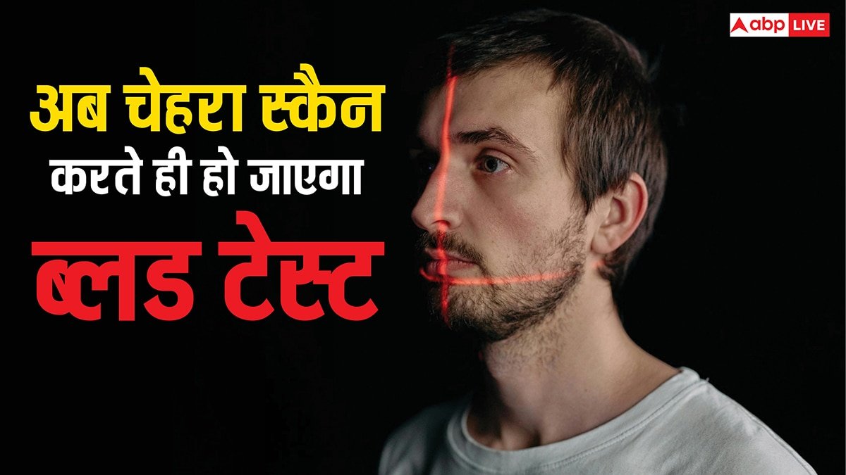 ब्लड टेस्ट करने की आई नई तकनीक! न लगेगी सुई और नहीं होगा दर्द, बस चेहरे होगा स्कैन और...