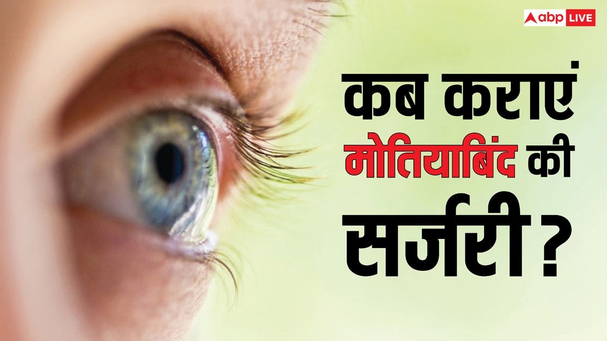 मोतियाबिंद होने के तुरंत बाद करानी होती है सर्जरी? जान लीजिए जवाब