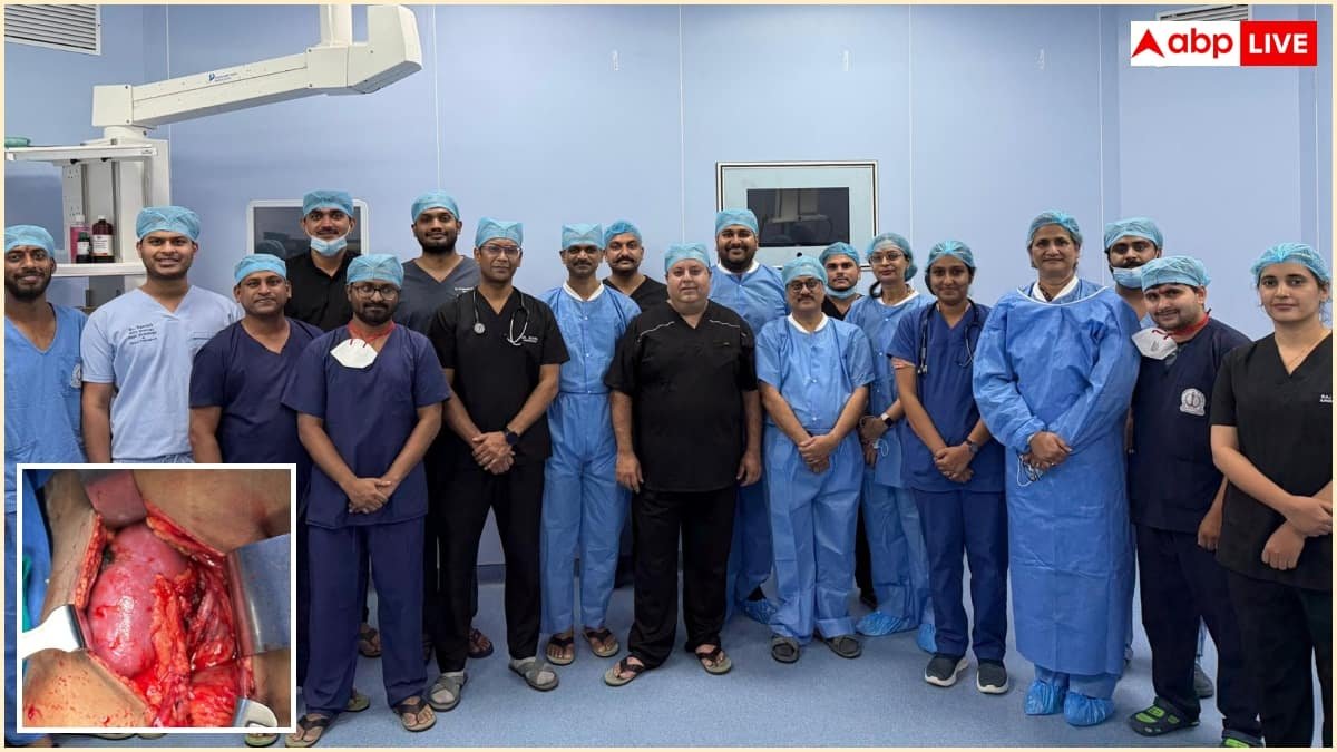 सफदरजंग अस्पताल ने रचा इतिहास, पहली बार 11 साल के बच्चे का सफल किडनी ट्रांसप्लांट