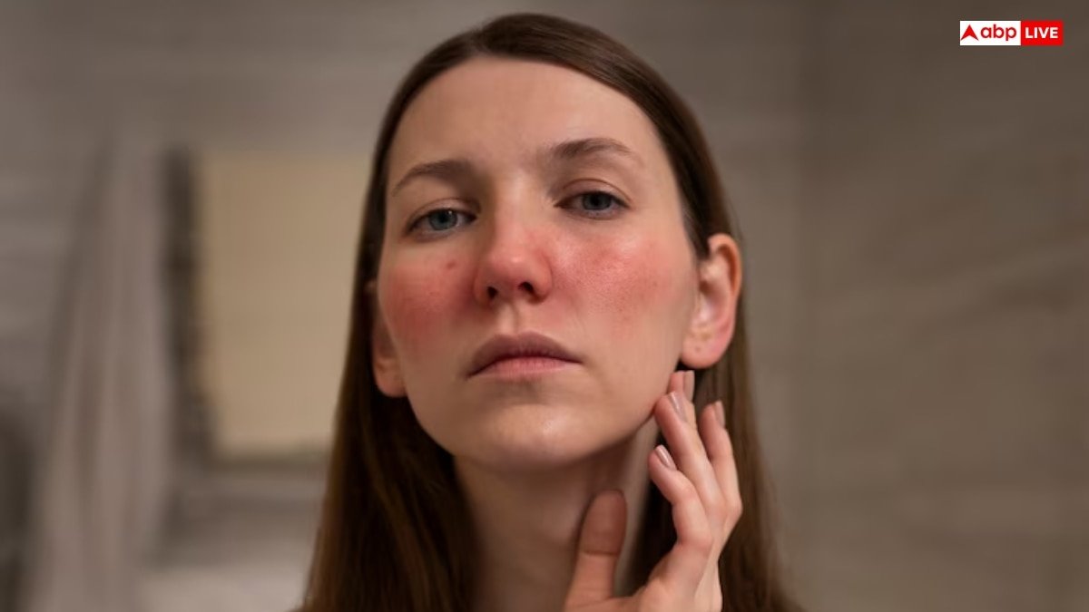 इन चीजों की वजह से होती है सबसे ज्यादा पिगमेंटेशन, ऐसे कर सकते हैं बचाव