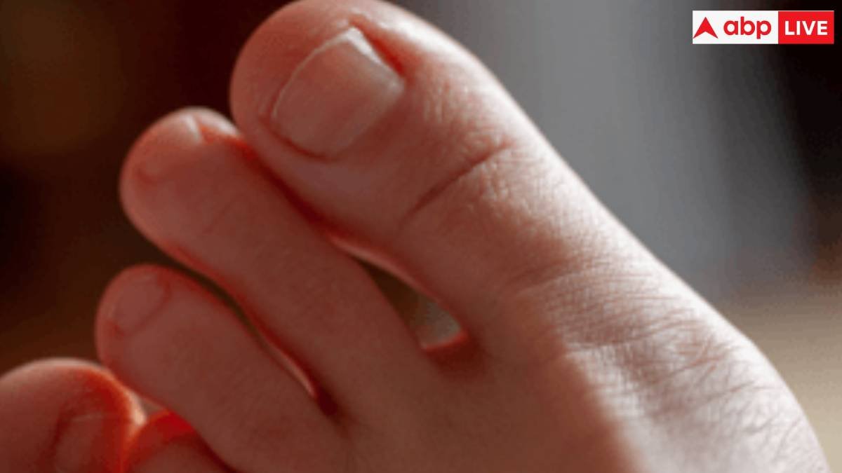 आपकी भी पैर की उंगली अंगूठे से बड़ी है? 50 के बाद हो सकती है ये समस्या