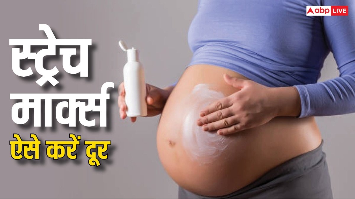 प्रेग्नेंसी के दौरान स्ट्रेच मार्क्स से बचने के लिए लगाएं ये वाला तेल, नहीं दिखेगा एक भी निशान