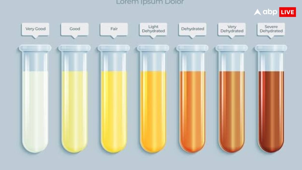 पेशाब के रंग ही नहीं गंध से भी पता चलती है बीमारी, कहीं आप भी तो नहीं कर रहें इग्नोर?