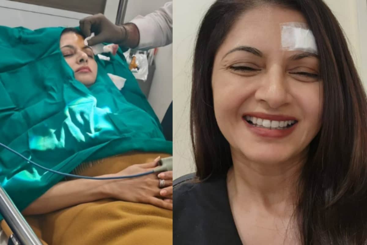Bhagyashree Picks Up Forehead Injury While Playing Pickleball, Gets 13 Stitches