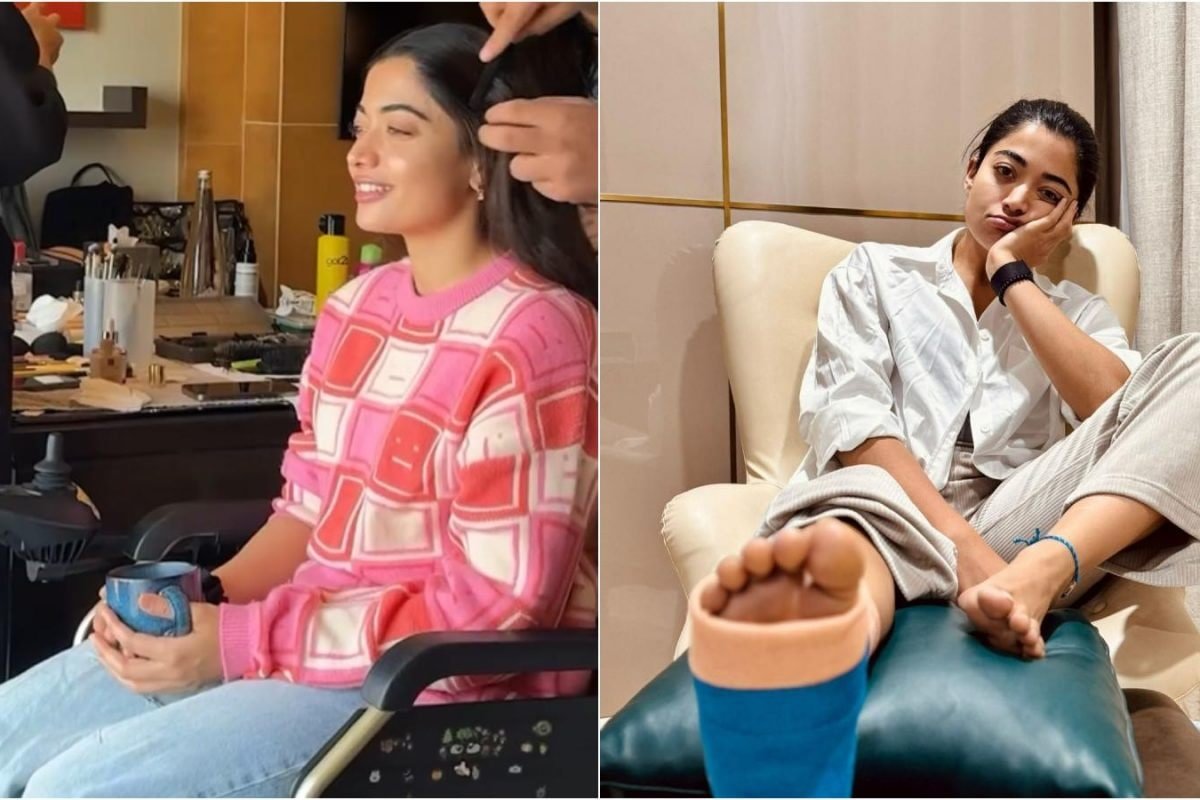 Rashmika Mandanna Shows X-Ray Of Injured Foot With 3 Fractures And A Muscle Tear: ‘Smiling Through It All…’